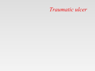 Traumatic ulcer
 