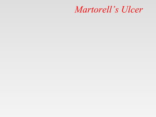 Martorell’s Ulcer
 
