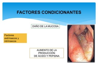 FACTORES CONDICIONANTES
DAÑO DE LA MUCOSA
AUMENTO DE LA
PRODUCCIÓN
DE ÁCIDO Y PEPSINA
Factores
extrínsecos y
intrínsecos
 