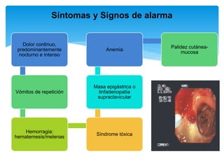 Dolor continuo,
predominantemente
nocturno e intenso
Vómitos de repetición
Hemorragia:
hematemesis/melenas
Síndrome tóxica
Masa epigástrica o
linfadenopatía
supraclavicular
Anemia
Palidez cutánea-
mucosa
Síntomas y Signos de alarma
 