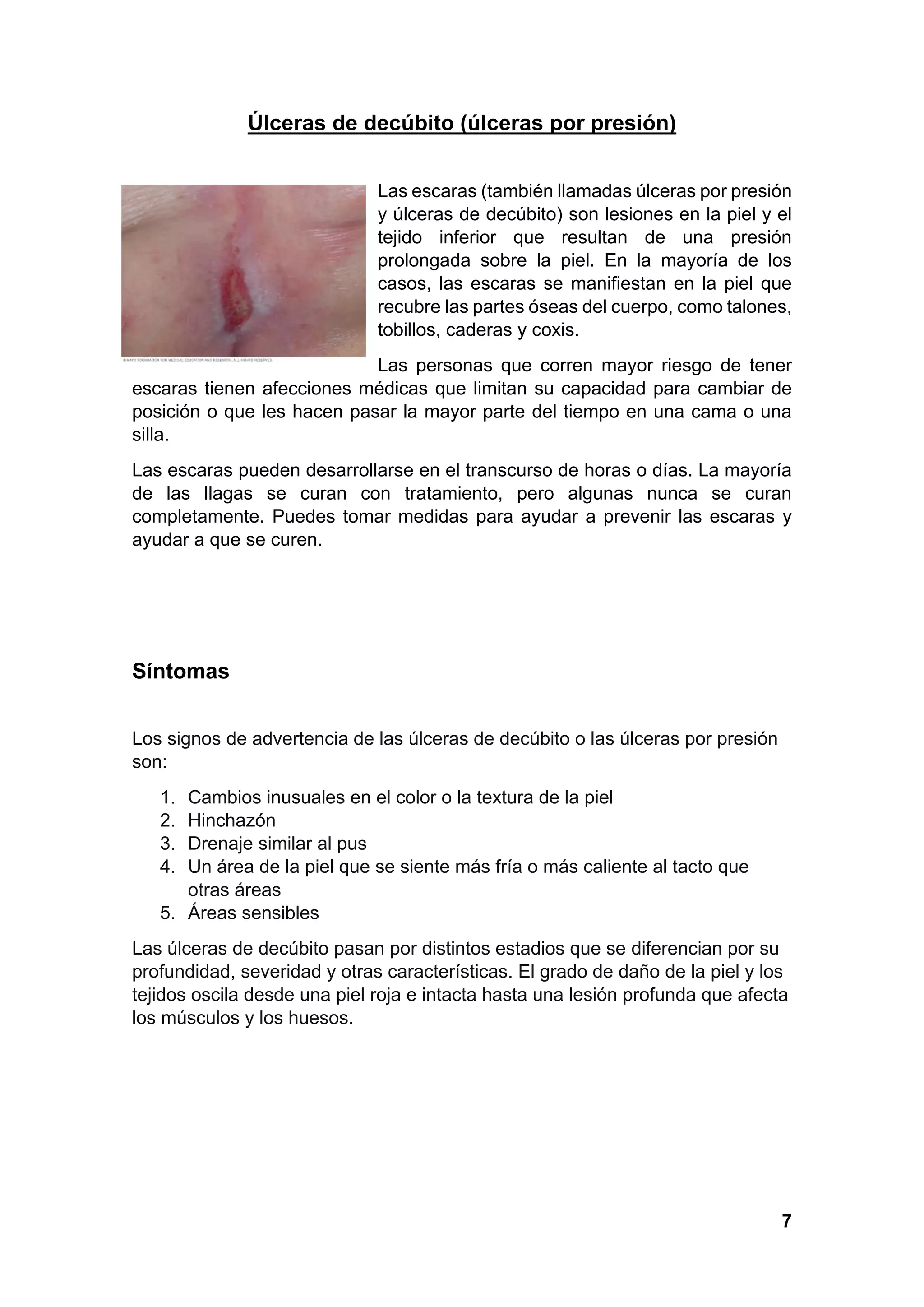 Ulcera decubito | PDF
