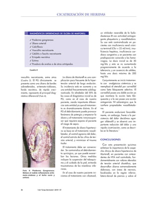 36 | Act Terap Dermatol | 2014 | 37
CICATRIZACIÓN DE HERIDAS
vasculitis necrotizante, entre otros
(Cuadro 2). El PG clínicamente se
presenta como una úlcera de bordes
sobreelevados, eritemato-violáceos,
fondo necrótico, de rápido creci-
miento, representa el principal diag-
nóstico diferencial (Foto 4).
La úlcera de Martorell es una com-
plicación poco frecuente de la hiper-
tensión arterial de larga evolución.
Su incidencia está en aumento y es
una entidad frecuentemente subdiag-
nosticada. En alrededor del 50% de
los casos el diagnóstico inicial es de
PG, como en el caso de nuestro
paciente, siendo importante diferen-
ciar esta entidad ya que el tratamien-
to es dramáticamente distinto. En el
PG el debridamiento puede provocar
fenómeno de patergia y empeorar la
úlcera y el tratamiento inmunosupre-
sor que requiere expone al paciente
al riesgo de sepsis.
El tratamiento de úlcera hipertensi-
va se basa en el tratamiento vasodi-
latador, el control agresivo del dolor,
el control estricto de las cifras de ten-
sión arterial, y minimizar el trauma
tisular.
El tratamiento debe ser conserva-
dor. Se contraindica el debridamien-
to quirúrgico, ya que puede exacer-
bar las lesiones. Otras medidas
incluyen la suspensión del tabaquis-
mo y el cuidado de la piel, evitando
traumatismos de los miembros infe-
riores.
En el caso de nuestro paciente ini-
ciamos el tratamiento con cilostazol,
un inhibidor reversible de la fosfo-
diesterasa III con actividad antiagre-
gante plaquetaria y vasodilatadora.
Su uso está contraindicado en pa-
cientes con insuficiencia renal cróni-
ca terminal (Clcr < 25 ml/min), insu-
ficiencia hepática, insuficiencia car-
díaca congestiva y en pacientes con
predisposición conocida a las hemo-
rragias. La dosis inicial es de 50
mg/día y esta se va aumentando
progresivamente de acuerdo a la
tolerancia, y en ausencia de cefalea,
hasta una dosis máxima de 200
mg/día.
Conjuntamente se inició tratamien-
to con analgésicos sistémicos y se
reemplazó el atenolol por carvedilol
como beta bloqueante selectivo. El
carvedilol posee una doble acción ya
que mantiene la acción beta blo-
queante y a la vez posee una acción
antagonista N1-adrenérgica que le
confiere propiedades vasodilatado-
ras.
El paciente evolucionó favorable-
mente, sin embargo, frente a la per-
sistencia del dolor decidimos agre-
gar sildenafil y se observó una im-
portante reducción del dolor y una
rápida cicatrización, como se descri-
be en la literatura.7
CONCLUSIONES
Con esta presentación quisimos
enfatizar la importancia de la sospe-
cha clínica de úlcera hipertensiva de
Martorell, en pacientes con antece-
dentes de HTA mal controlada, fun-
damentalmente con valores elevados
de tensión arterial diastólica, que
desarrollan úlceras extremadamente
dolorosas, con áreas de necrosis,
localizadas en la región inferior,
latero-dorsal de piernas y sobre el
Foto 4: Pioderma Gangrenoso.
Nótese el rodete inflamatorio erite-
mato-violáceo y el lecho sucio y
sañoso.
Cuadro II
DIAGNÓSTICOS DIFERENCIALES DE ÚLCERA DE MARTORELL
✓ Pioderma gangrenoso
✓ Úlcera arterial
✓ Calcifilaxis
✓ Vasculitis necrotizante
✓ Celulitis o fascitis necrotizante
✓ Erisipela necrótica
✓ Ectima
✓ Picadura de arañas o de otros artrópodos
 