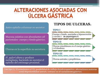 Antro epitelio columnar no secretor.
Mucosa oxíntica con abundantes cél
parientales- cuerpo y fondo gástrico.
Úlceras en la superficie no secretora.
H. pylori altera y produce
metaplasia, haciendo no secretor el
epitelio del estómago proximal.
Cuerpo y fondo, asociadas a hiposecreción
y niveles ↑ de pepsinógeno II.
Úlceras simultáneas en el cuerpo gástrico
y el duodeno.
Úlceras antrales y prepilóricas.
Las tipo I y II semejantes a UD, posibilidad de reflujo duodenogástrico, alteraciones motoras
como hipomotilidad antral y retraso en el vaciamientogástrico.
 