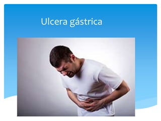 Ulcera gástrica
 
