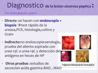 Diagnostico de la lesion ulcerosa peptica :
 Por helicobacter pylori:

• Directo :se hacen con endoscopia +
  biopsia test rápido de la
  ureasa,PCR, histología,cultivo y
  Gram

• Indirecto:no endoscopia:serología,
  prueba del aliento espirado con
  urea-13C o urea-14C y detección del
  antígeno en heces de HP

• Otras pruebas :estudios de
  secrecion acida gastrica BAO , MAO
 