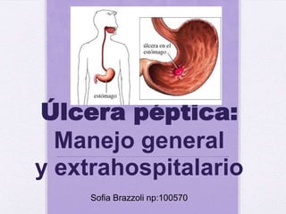 Úlcera péptica:
  Manejo general
y extrahospitalario
     Sofia Brazzoli np:100570
 
