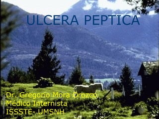 ULCERA PEPTICA
Dr. Gregorio Mora Orozco
Médico Internista
ISSSTE- UMSNH
 