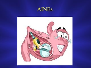 AINEs
 