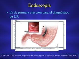 Endoscopía
• Es de primera elección para el diagnóstico
de UP.
Y. Ver Nieto. 2012. Protocolo terapéutico de la úlcera péptica. Protocolos de practica asistencial. Págs. 179-
82
 