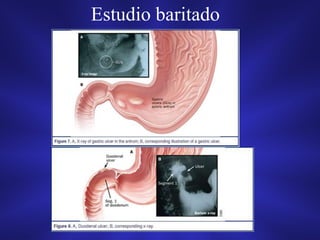Estudio baritado
 