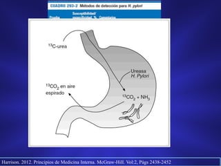 Harrison. 2012. Principios de Medicina Interna. McGraw-Hill. Vol:2, Págs 2438-2452
 