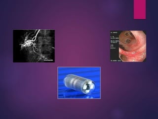 Ulcera peptica. 2017