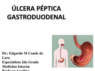 ÚLCERA PÉPTICA
GASTRODUODENAL
Dr.: Edgardo M Conde de
Lara
Especialista 2do Grado
Medicina Interna
 