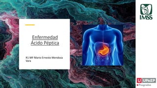 Enfermedad
Ácido Péptica
R1 MF Mario Ernesto Mendoza
Vara
 