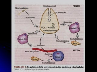 ULCERA PEPTICA Gatrica - Medicina pregrado
