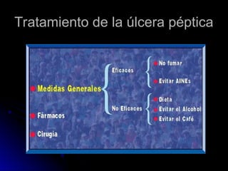Tratamiento de la úlcera péptica
Tratamiento de la úlcera péptica
 