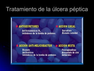 Tratamiento de la úlcera péptica
Tratamiento de la úlcera péptica
 