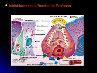  Inhibidores de la Bomba de Protones
Inhibidores de la Bomba de Protones
 