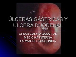ÚLCERAS GÁSTRICAS Y
ÚLCERAS GÁSTRICAS Y
ÚLCERA DUODENAL
ÚLCERA DUODENAL
CESAR GARCIA CASALLAS
CESAR GARCIA CASALLAS
MEDICINA INTERNA
MEDICINA INTERNA
FARMACOLOGIA CLINICA
FARMACOLOGIA CLINICA
 
