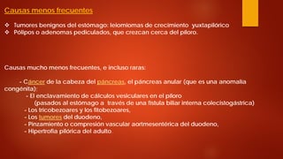 Causas menos frecuentes 
 
Tumores benignos del estómago: leiomiomas de crecimiento yuxtapilórico 
 
Pólipos o adenomas pediculados, que crezcan cerca del píloro. Causas mucho menos frecuentes, e incluso raras: - Cáncer de la cabeza del páncreas, el páncreas anular (que es una anomalía congénita); - El enclavamiento de cálculos vesiculares en el píloro (pasados al estómago a través de una fístula biliar interna colecistogástrica) - Los tricobezoares y los fitobezoares, - Los tumores del duodeno, - Pinzamiento o compresión vascular aortmesentérica del duodeno, - Hipertrofia pilórica del adulto.  