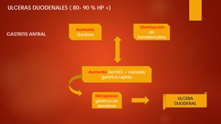 ULCERAS DUODENALES ( 80- 90 % HP +) GASTRITIS ANTRAL 
Aumento Gastrina 
Disminucion de Somatostatina 
Aumento del HCL + vaciado gástrico rapido 
Metaplasia gástrica en duodeno 
ULCERA DUODENAL  