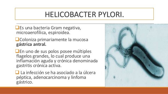 Ulcera peptica e infeccion por helicobacter pylori