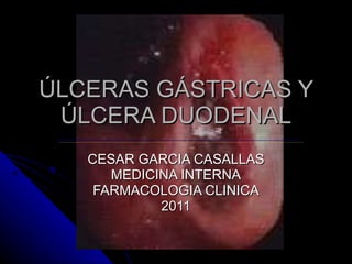 ÚLCERAS GÁSTRICAS Y ÚLCERA DUODENAL CESAR GARCIA CASALLAS MEDICINA INTERNA FARMACOLOGIA CLINICA 2011 