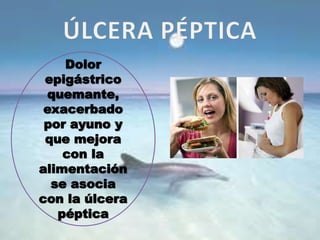 Dolor
epigástrico
quemante,
exacerbado
por ayuno y
que mejora
con la
alimentación
se asocia
con la úlcera
péptica
 