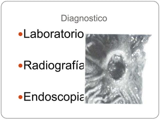 Diagnostico LaboratorioRadiografía Endoscopia  