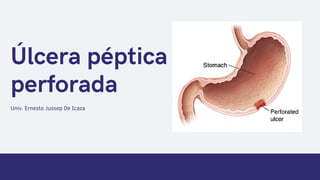 Úlcera péptica
perforada
Univ. Ernesto Jussep De Icaza
 