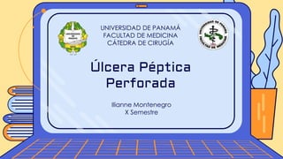 Ilianne Montenegro
X Semestre
Úlcera Péptica
Perforada
UNIVERSIDAD DE PANAMÁ
FACULTAD DE MEDICINA
CÁTEDRA DE CIRUGÍA
 