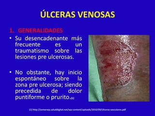 ÚLCERAS VENOSAS
1. GENERALIDADES
• Su desencadenante más
  frecuente       es      un
  traumatismo sobre las
  lesiones pre ulcerosas.

• No obstante, hay inicio
  espontáneo sobre la
  zona pre ulcerosa; siendo
  precedida     de     dolor
  puntiforme o prurito.(1)
       (1) http://semerwp.saluddigital.net/wp-content/uploads/2010/09/Ulceras-vasculares.pdf
 