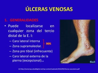 ÚLCERAS VENOSAS
1. GENERALIDADES
• Puede       localizarse en
  cualquier zona del tercio
  distal de la E. I:
  –   Cara lateral interna
                               90%
  –   Zona supramaleolar.
  –   Zona pre tibial (infrecuente)
  –   Cara lateral externa de la
      pierna (excepcional).                (1)




          (1) http://semerwp.saluddigital.net/wp-content/uploads/2010/09/Ulceras-vasculares.pdf
 