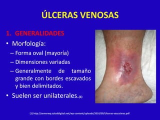 ÚLCERAS VENOSAS
1. GENERALIDADES
• Morfología:
 – Forma oval (mayoría)
 – Dimensiones variadas
 – Generalmente de tamaño
   grande con bordes escavados
   y bien delimitados.
• Suelen ser unilaterales.(1)

         (1) http://semerwp.saluddigital.net/wp-content/uploads/2010/09/Ulceras-vasculares.pdf.
 