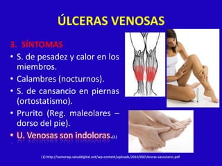 ÚLCERAS VENOSAS
3. SÍNTOMAS
• S. de pesadez y calor en los
  miembros.
• Calambres (nocturnos).
• S. de cansancio en piernas
  (ortostatismo).
• Prurito (Reg. maleolares –
  dorso del pie).
• U. Venosas son indoloras.(1)

        (1) http://semerwp.saluddigital.net/wp-content/uploads/2010/09/Ulceras-vasculares.pdf.
 