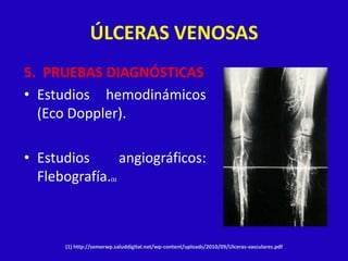 ÚLCERAS VENOSAS
5. PRUEBAS DIAGNÓSTICAS
• Estudios hemodinámicos
  (Eco Doppler).

• Estudios     angiográficos:
  Flebografía.         (1)




      (1) http://semerwp.saluddigital.net/wp-content/uploads/2010/09/Ulceras-vasculares.pdf
 