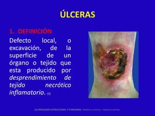ÚLCERAS
1. DEFINICIÓN
Defecto    local,    o
excavación, de la
superficie de un
órgano o tejido que
esta producido por
desprendimiento de
tejido       necrótico
inflamatorio. (1)

        (1) PATOLOGÍA ESTRUCTURAL Y FUNCIONAL: Robbins y Cotran – Séptima edición.
 