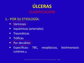 ÚLCERAS
                      CLASIFICACIÓN
1.- POR SU ETIOLOGÍA:
     Varicosas
     Isquémicas (arteriales)
     Traumáticas
     Tróficas
     Por decúbito
     Específicas: TBC, neoplásicas,                                            leishmaniasis
      cutánea.(1)

             (1) Exposición teórica de úlceras: Dr. César Vargas Muñoz - 2008
 