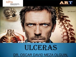 ULCERAS
DR. OSCAR DAVID MEZA OLGUIN.
 
