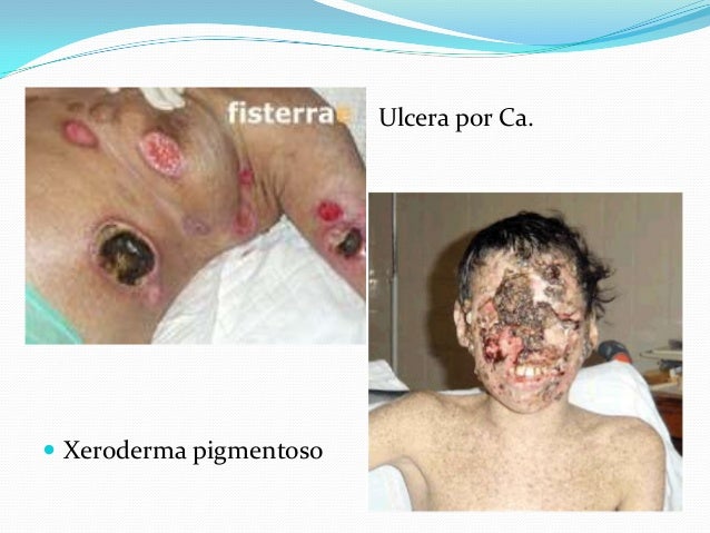 La crema la cera es sana de varikoza comprar en kieve