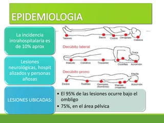 La incidencia
intrahospitalaria es
de 10% aprox
Lesiones
neurológicas, hospit
alizados y personas
añosas
• El 95% de las lesiones ocurre bajo el
ombligo
• 75%, en el área pélvica
LESIONES UBICADAS:
 