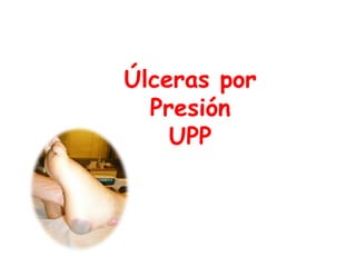 Úlceras por
  Presión
    UPP
 