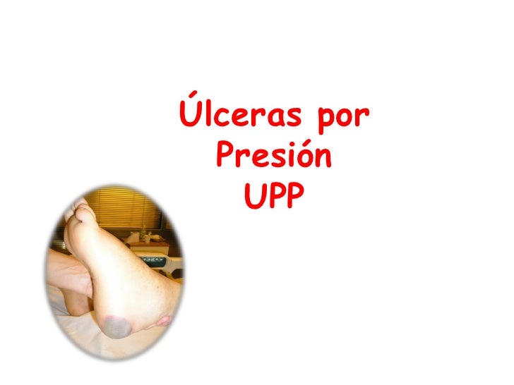 Aprender más sobre contraindicaciones de la chia en hipertensión