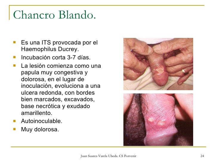 El instituto flebologii en g moskve