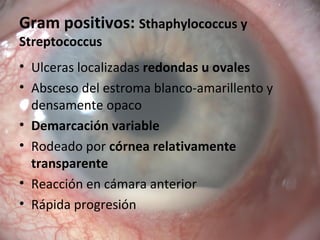 Gram positivos: Sthaphylococcus y
Streptococcus
• Ulceras localizadas redondas u ovales
• Absceso del estroma blanco-amarillento y
densamente opaco
• Demarcación variable
• Rodeado por córnea relativamente
transparente
• Reacción en cámara anterior
• Rápida progresión
 
