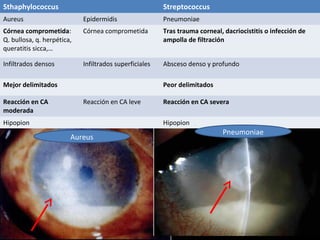 Sthaphylococcus Streptococcus
Aureus Epidermidis Pneumoniae
Córnea comprometida:
Q. bullosa, q. herpética,
queratitis sicca,…
Córnea comprometida Tras trauma corneal, dacriocistitis o infección de
ampolla de filtración
Infiltrados densos Infiltrados superficiales Absceso denso y profundo
Mejor delimitados Peor delimitados
Reacción en CA
moderada
Reacción en CA leve Reacción en CA severa
Hipopion Hipopion
Aureus
Pneumoniae
 