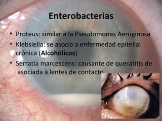 Enterobacterias
• Proteus: similar a la Pseudomonas Aeruginosa
• Klebsiella: se asocia a enfermedad epitelial
crónica (Alcohólicos)
• Serratia marcescens: causante de queratitis de
asociada a lentes de contacto
 