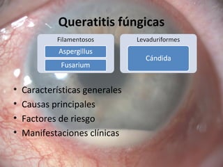 Queratitis fúngicas
• Características generales
• Causas principales
• Factores de riesgo
• Manifestaciones clínicas
 