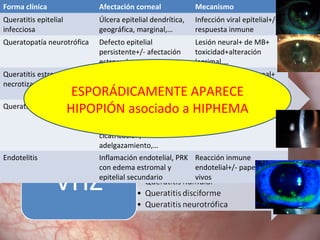Forma clínica Afectación corneal Mecanismo
Queratitis epitelial
infecciosa
Úlcera epitelial dendrítica,
geográfica, marginal,…
Infección viral epitelial+/-
respuesta inmune
Queratopatía neurotrófica Defecto epitelial
persistente+/- afectación
estromal
Lesión neural+ de MB+
toxicidad+alteración
lagrimal,…
Queratitis estromal
necrotizante
Infiltración estromal
intensa con ulceración y
necrosis
Infección viral estromal+
reacción inmune grave
Queratitis estromal inmune Infiltración, edema,
neovascularización,
exudación lipoidea,
cicatrización,
adelgazamiento,…
Reacción inmune estromal
+/- papel de virus vivos
Endotelitis Inflamación endotelial, PRK
con edema estromal y
epitelial secundario
Reacción inmune
endotelial+/- papel de virus
vivos
ESPORÁDICAMENTE APARECE
HIPOPIÓN asociado a HIPHEMA
 