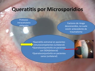 Queratitis por Microsporidios
Protozoo
intracelulares
obligados
•Queratitis estromal en pacientes
inmunocompetentes (unilateral)
•Queratoconjuntivitis en pacientes
con SIDA(bilateral)
•Queratoconjuntivitis en pacientes
sanos (unilateral)
Factores de riesgo
desconocidos, no suele
existir antecedente de
traumatismo
 